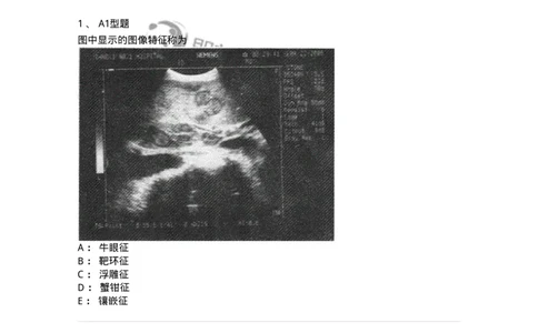 1008-2025年军队文职考试《医学影像技术》模拟预测6-137860_军队文职(1)_01.军队文职真题-专业课_（全）版本一（历年真题+章节练习+模拟题）_医学影像技术(军队文职)_预测模拟_纯题目