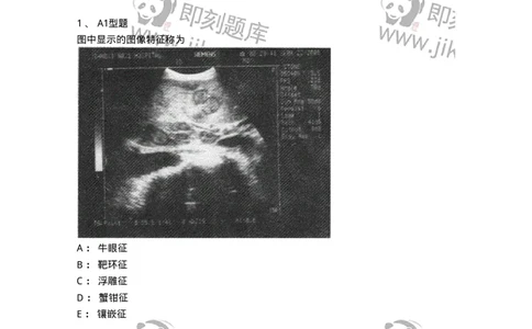 1008-2025年军队文职考试《医学影像技术》模拟预测6-137860_军队文职(1)_01.军队文职真题-专业课_（全）版本一（历年真题+章节练习+模拟题）_医学影像技术(军队文职)_预测模拟_题目+解析
