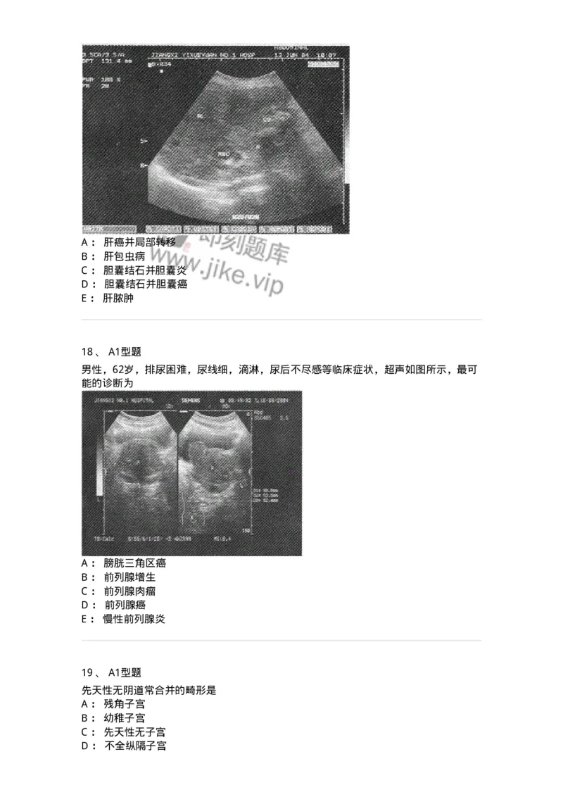 815027-专业实践能力强化练习-174665_军队文职(1)_01.军队文职真题-专业课_（全）版本一（历年真题+章节练习+模拟题）_医学影像技术(军队文职)_章节练习_纯题目