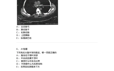 905-2025年军队文职考试《医学影像技术》模拟预测3-137857_军队文职(1)_01.军队文职真题-专业课_（全）版本一（历年真题+章节练习+模拟题）_医学影像技术(军队文职)_预测模拟_纯题目