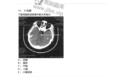 905-2025年军队文职考试《医学影像技术》模拟预测3-137857_军队文职(1)_01.军队文职真题-专业课_（全）版本一（历年真题+章节练习+模拟题）_医学影像技术(军队文职)_预测模拟_纯题目
