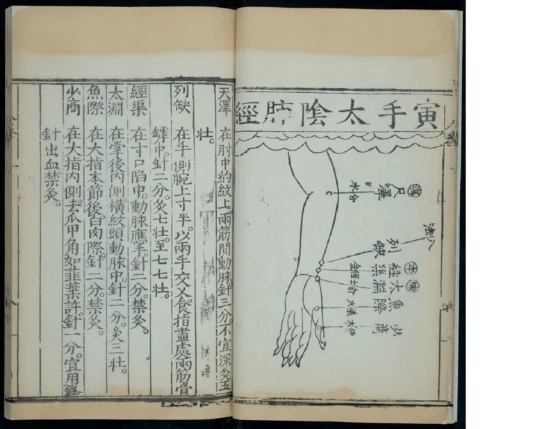 11_绝版书_天涯系列_t涯_绝版古籍电子书合集（13大类）_医书类_针灸大成