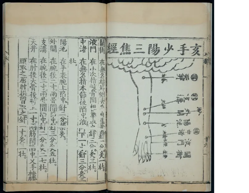 11_绝版书_天涯系列_t涯_绝版古籍电子书合集（13大类）_医书类_针灸大成