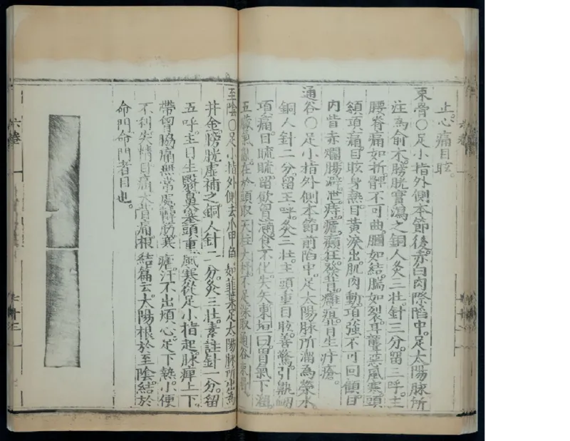 8_绝版书_天涯系列_t涯_绝版古籍电子书合集（13大类）_医书类_针灸大成