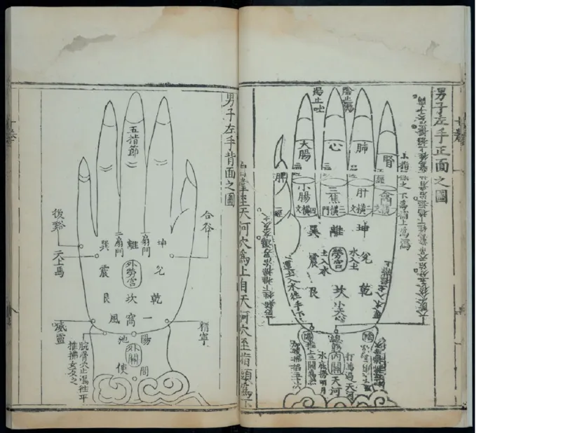 15_绝版书_天涯系列_t涯_绝版古籍电子书合集（13大类）_医书类_针灸大成