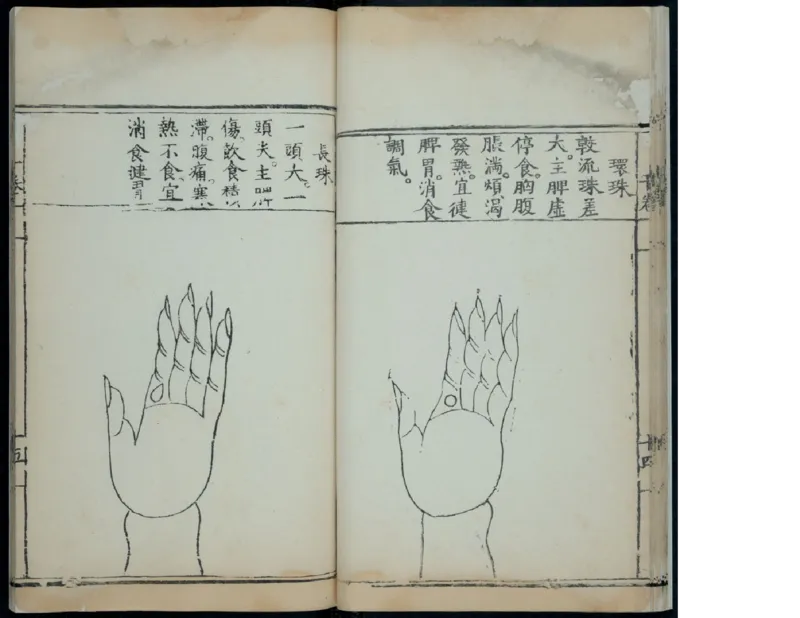 15_绝版书_天涯系列_t涯_绝版古籍电子书合集（13大类）_医书类_针灸大成