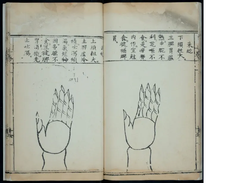 15_绝版书_天涯系列_t涯_绝版古籍电子书合集（13大类）_医书类_针灸大成