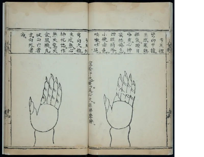 15_绝版书_天涯系列_t涯_绝版古籍电子书合集（13大类）_医书类_针灸大成