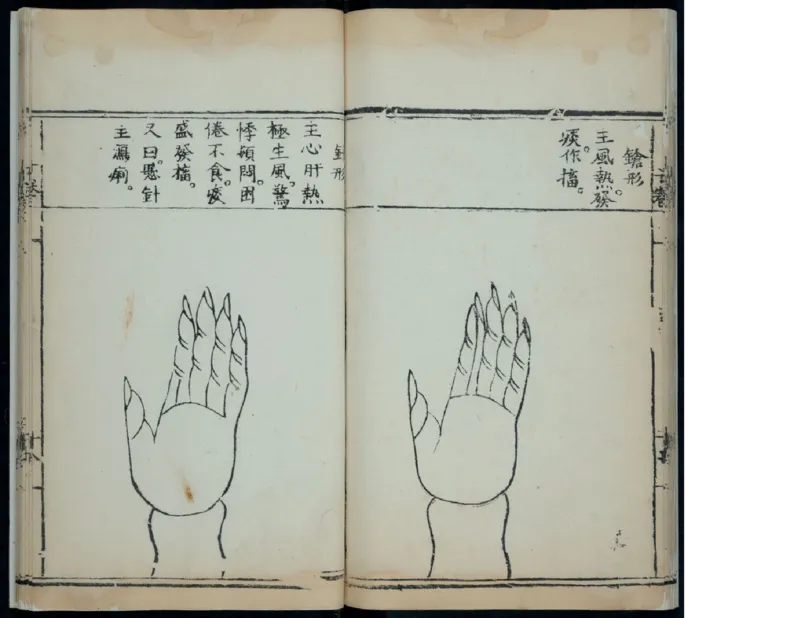 15_绝版书_天涯系列_t涯_绝版古籍电子书合集（13大类）_医书类_针灸大成