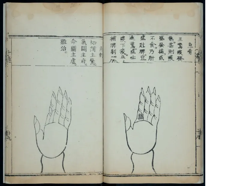 15_绝版书_天涯系列_t涯_绝版古籍电子书合集（13大类）_医书类_针灸大成