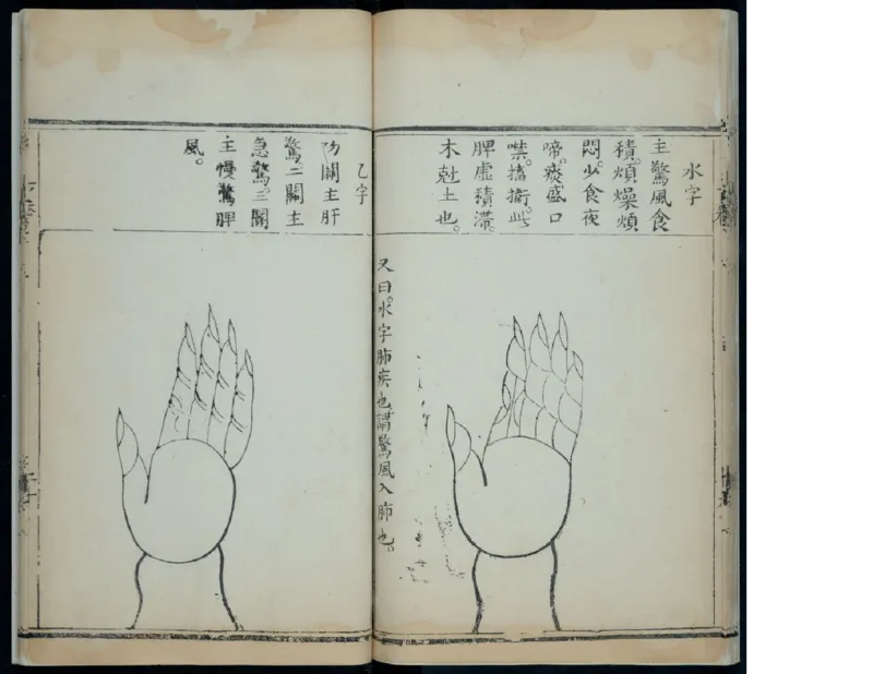 15_绝版书_天涯系列_t涯_绝版古籍电子书合集（13大类）_医书类_针灸大成