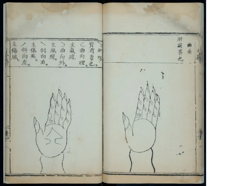 15_绝版书_天涯系列_t涯_绝版古籍电子书合集（13大类）_医书类_针灸大成