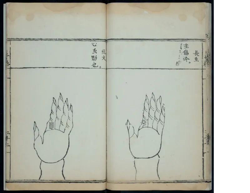 15_绝版书_天涯系列_t涯_绝版古籍电子书合集（13大类）_医书类_针灸大成