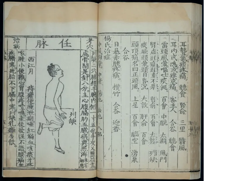 6_绝版书_天涯系列_t涯_绝版古籍电子书合集（13大类）_医书类_针灸大成