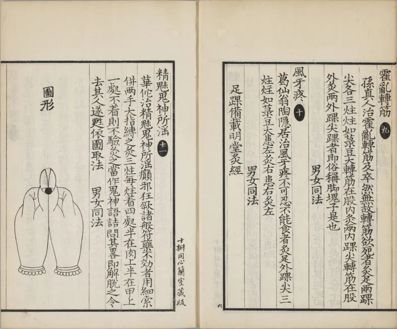 备急灸方.一卷.南宋.闻人耆年.撰.上杭罗氏十瓣同心兰室藏版.清光绪十六年影宋刊本(1)_绝版书_天涯系列_t涯_绝版古籍电子书合集（13大类）_医书类