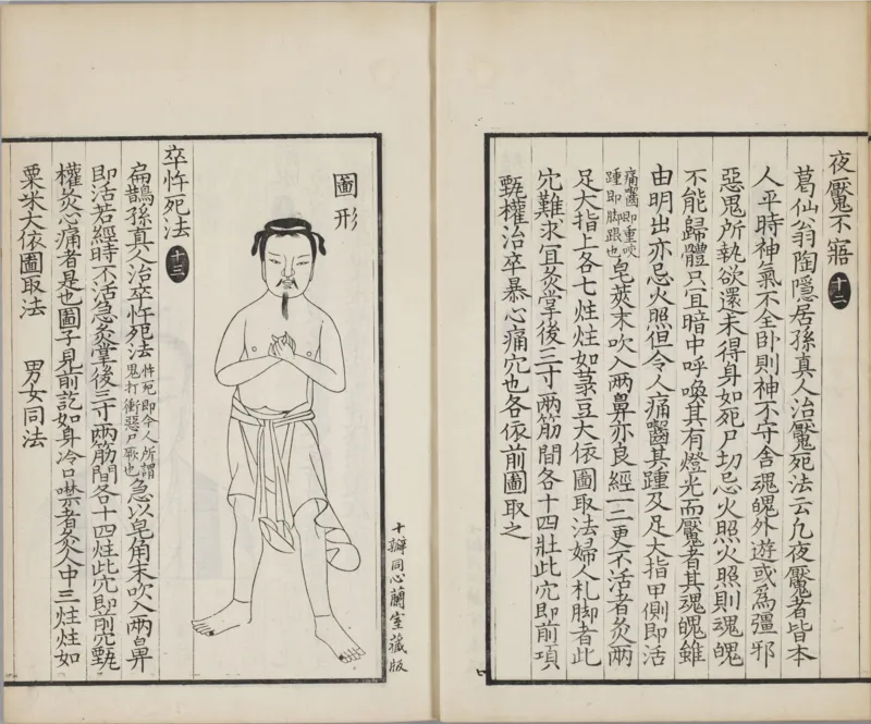 备急灸方.一卷.南宋.闻人耆年.撰.上杭罗氏十瓣同心兰室藏版.清光绪十六年影宋刊本(1)_绝版书_天涯系列_t涯_绝版古籍电子书合集（13大类）_医书类