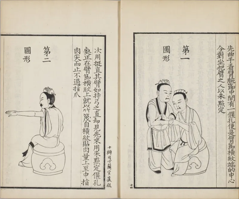 备急灸方.一卷.南宋.闻人耆年.撰.上杭罗氏十瓣同心兰室藏版.清光绪十六年影宋刊本(1)_绝版书_天涯系列_t涯_绝版古籍电子书合集（13大类）_医书类