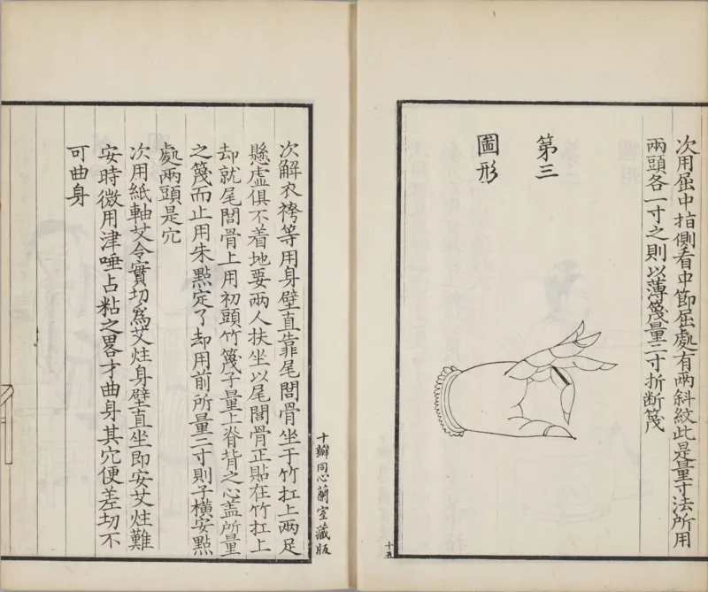 备急灸方.一卷.南宋.闻人耆年.撰.上杭罗氏十瓣同心兰室藏版.清光绪十六年影宋刊本(1)_绝版书_天涯系列_t涯_绝版古籍电子书合集（13大类）_医书类