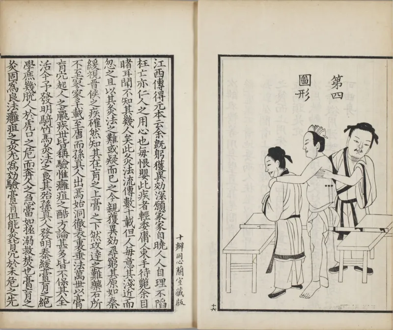 备急灸方.一卷.南宋.闻人耆年.撰.上杭罗氏十瓣同心兰室藏版.清光绪十六年影宋刊本(1)_绝版书_天涯系列_t涯_绝版古籍电子书合集（13大类）_医书类