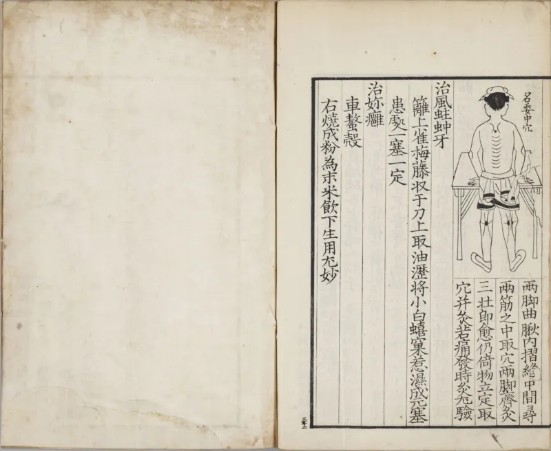 备急灸方.一卷.南宋.闻人耆年.撰.上杭罗氏十瓣同心兰室藏版.清光绪十六年影宋刊本(1)_绝版书_天涯系列_t涯_绝版古籍电子书合集（13大类）_医书类