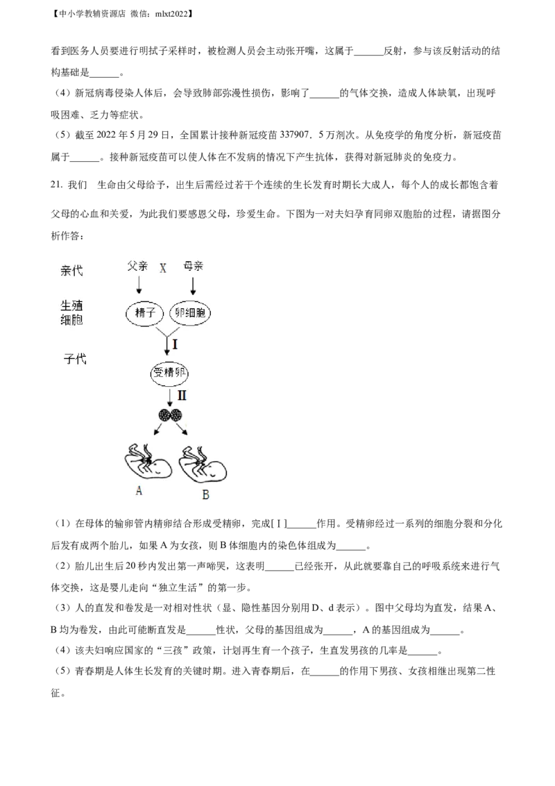 精品解析：2022年山东省枣庄市中考生物真题（原卷版）_中考真题_8.生物中考真题2015-2024年_2022年全国中考生物114份14