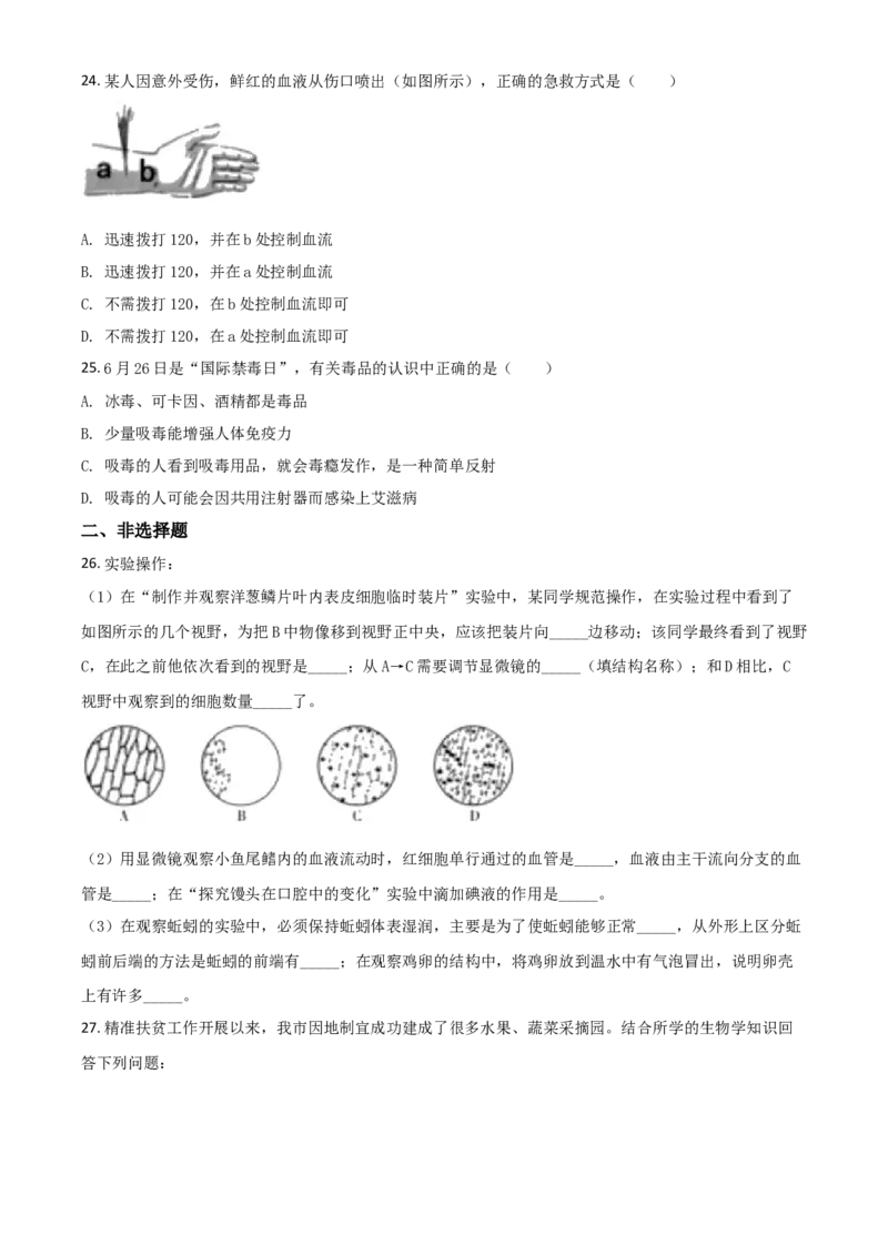 精品解析：湖北省宜昌市2020年中考生物试题（原卷版）_中考真题_8.生物中考真题2015-2024年_2020生物真题74份_2020年中考真题精品解析生物（湖北宜昌卷）精编word版