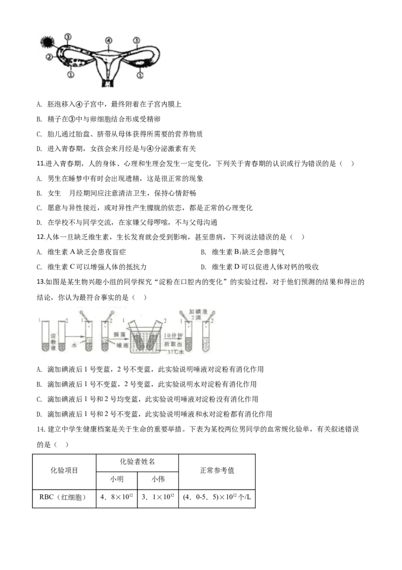 精品解析：山东省临沂市2020年中考生物试题（原卷版）_中考真题_8.生物中考真题2015-2024年_2020生物真题74份_2020年中考真题精品解析生物（山东临沂卷）精编word版