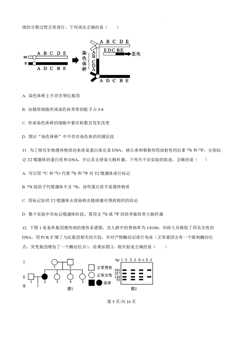 2025届江苏省高邮市高三10月学情调研-生物试题+答案_2024-2025高三（6-6月题库）_2024年10月试卷_1021江苏省高邮市2024-2025学年2025届高三（上）学期10月学情调研测试