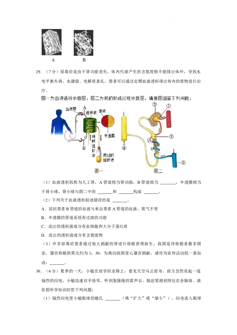 2022年湖南省益阳市中考生物试卷（解析版）_8.生物中考真题2015-2024年_地区卷_湖南省_益阳生物（15-22，少20,21）