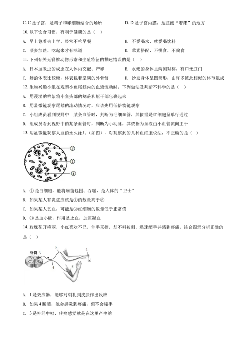 湖南省娄底市2021年中考生物试题（原卷版）_8.生物中考真题2015-2024年_地区卷_湖南省_湖南娄底生物18-22