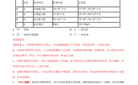 专题07&nbsp;人体内的物质运输和废物排出（解析版）_02中考总复习（2026版更新中）_08-生物-中考总复习_2024年中考复习资料_专项复习_完三年（2021-2023）中考生物真题分项汇编（全国通用）