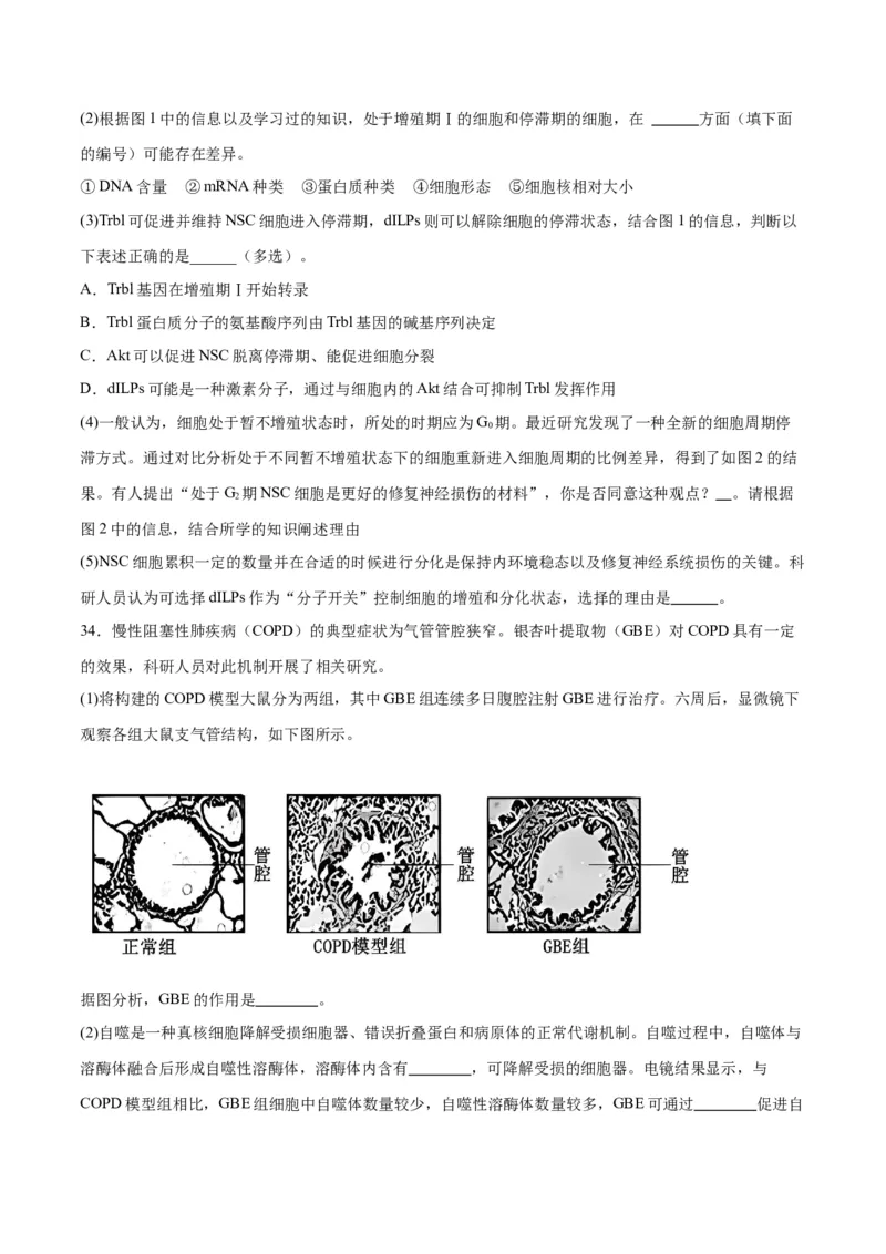 专题14细胞分化、衰老、凋亡和癌变（原卷版)_2024年新高考资料_3.2024专项复习_备战2024年高考生物一轮复习重难点专项突破_专题14细胞分化、衰老、凋亡和癌变
