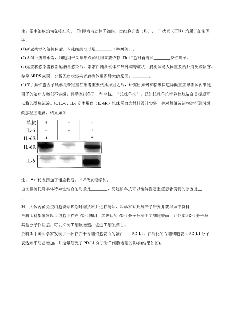 专题29免疫调节（原卷版)_2024年新高考资料_3.2024专项复习_备战2024年高考生物一轮复习重难点专项突破_专题29免疫调节-备战2024年高考生物一轮复习重难点专项突破