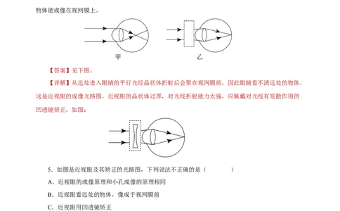5.4眼睛和眼镜（分层作业）-（人教版）解析版_初物_八年级上下册+九年级全一册物理_八年级物理上册_老课标资料_同步练习