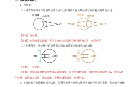 5.4眼睛和眼镜（分层作业）-（人教版）解析版_初物_八年级上下册+九年级全一册物理_八年级物理上册_老课标资料_同步练习