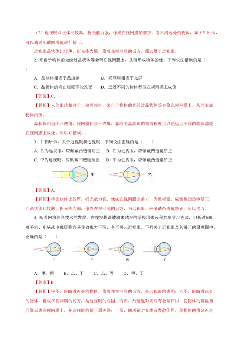 5.4眼睛和眼镜（导学案）-（人教版）教师版_初物_八年级上下册+九年级全一册物理_八年级物理上册_老课标资料_导学案