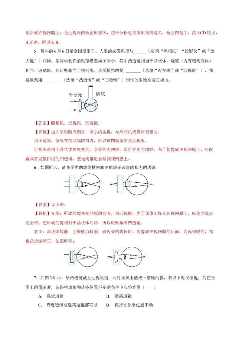 5.4眼睛和眼镜（导学案）-（人教版）教师版_初物_八年级上下册+九年级全一册物理_八年级物理上册_老课标资料_导学案