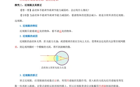 5.4眼睛和眼镜（导学案）-（人教版）教师版_初物_八年级上下册+九年级全一册物理_八年级物理上册_老课标资料_导学案
