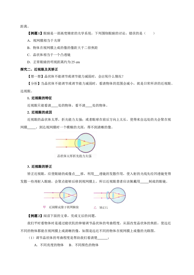 5.4眼睛和眼镜（导学案）-（人教版）学生版_初物_八年级上下册+九年级全一册物理_八年级物理上册_老课标资料_导学案