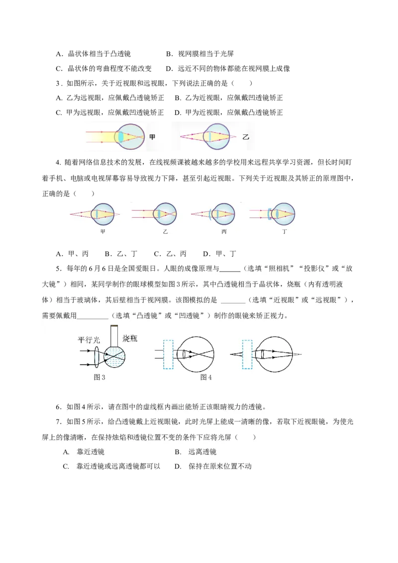 5.4眼睛和眼镜（导学案）-（人教版）学生版_初物_八年级上下册+九年级全一册物理_八年级物理上册_老课标资料_导学案