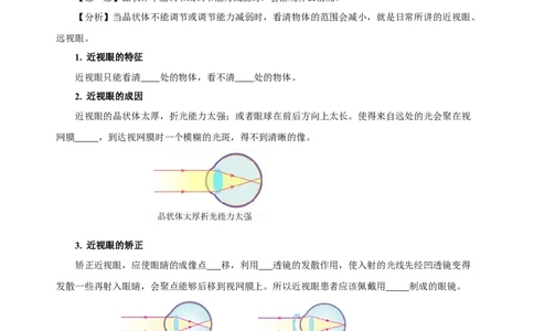 5.4眼睛和眼镜（导学案）-（人教版）学生版_初物_八年级上下册+九年级全一册物理_八年级物理上册_老课标资料_导学案