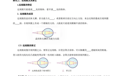 5.4眼睛和眼镜（导学案）-（人教版）学生版_初物_八年级上下册+九年级全一册物理_八年级物理上册_老课标资料_导学案