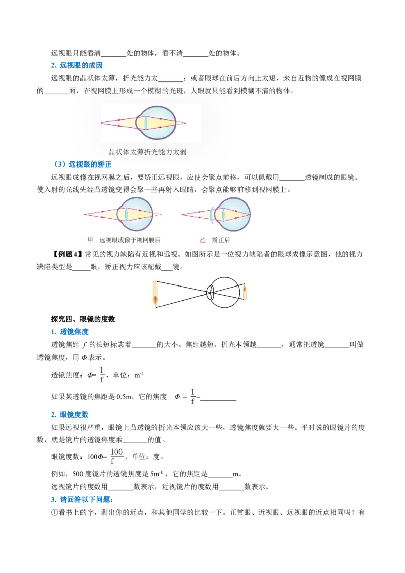 5.4眼睛和眼镜（导学案）学生版_初物_八年级上下册+九年级全一册物理_八年级物理上册_导学案（完）