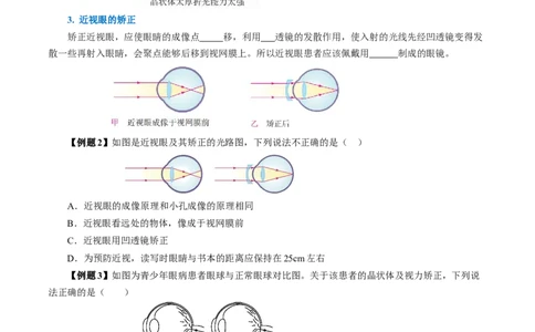 5.4眼睛和眼镜（导学案）学生版_初物_八年级上下册+九年级全一册物理_八年级物理上册_导学案（完）