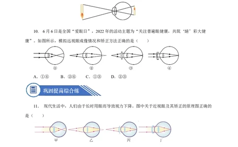 5.4眼睛和眼镜（分层作业）-（人教版）学生版_初物_八年级上下册+九年级全一册物理_八年级物理上册_老课标资料_同步练习