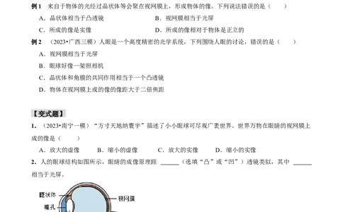 第五章凸透镜成像及其应用&middot;&middot;第4节眼睛和眼镜&middot;八年级上物理&middot;人教&middot;知识解讲+课后作用（学用）_初物_八年级上下册+九年级全一册物理_八年级物理上册_老课标资料_课件