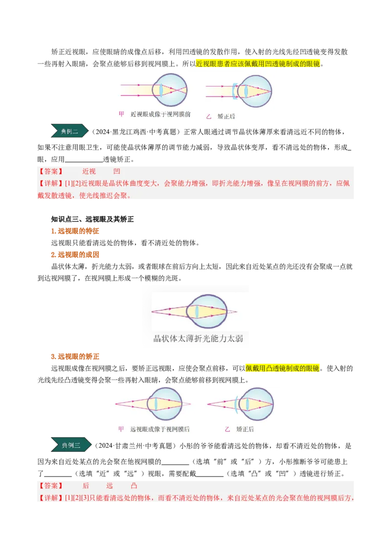课时5.4眼睛和眼镜（教师版）_初物_八年级上下册+九年级全一册物理_八年级物理上册_讲义