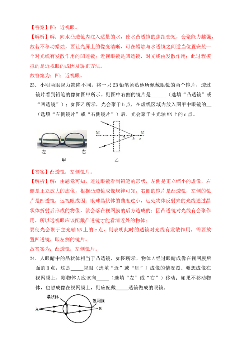 5.4眼睛和眼镜（同步练习）(解析版)_初中全科电子版试卷练习试题_物理_8年级上册物理试题_人教版物理八年级上课时练习（104份）_课时练习第1套53