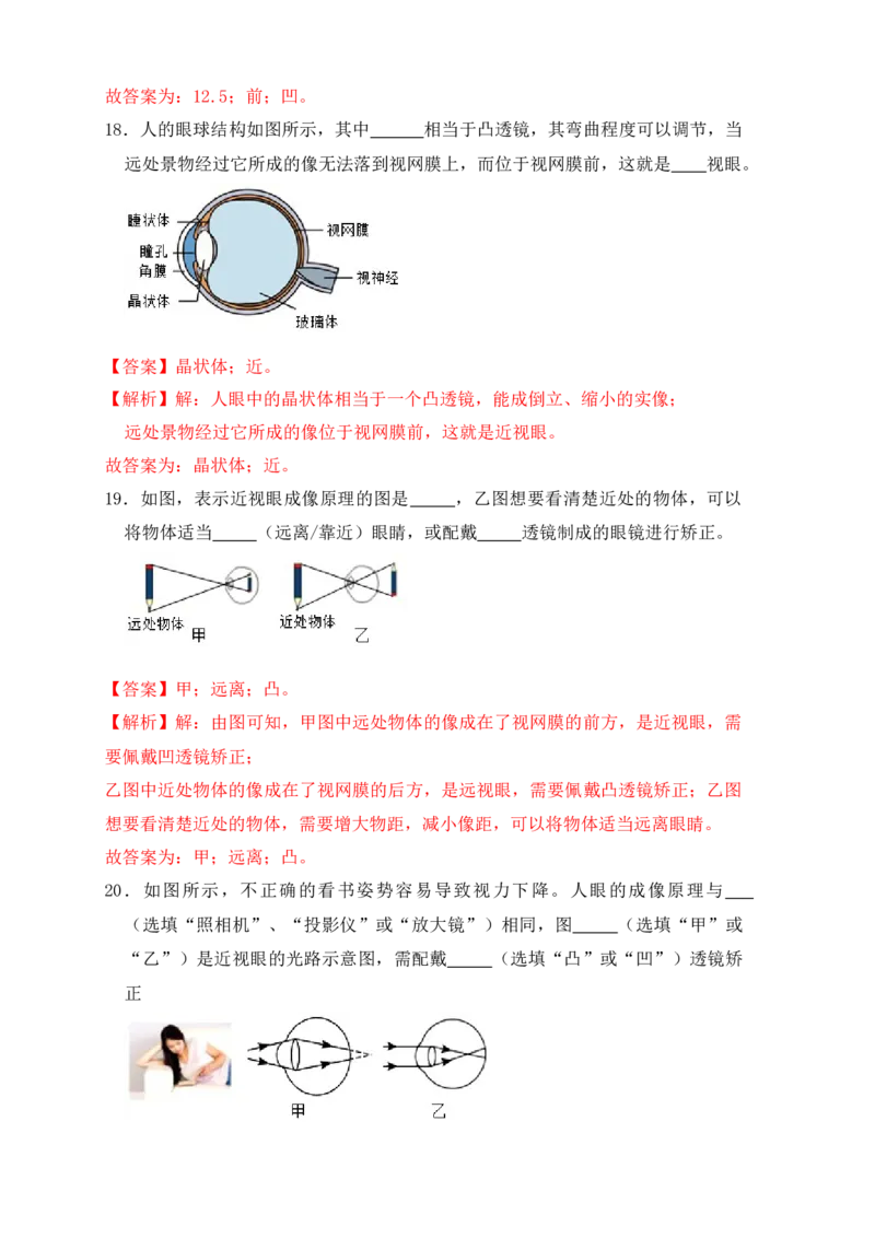 5.4眼睛和眼镜（同步练习）(解析版)_初中全科电子版试卷练习试题_物理_8年级上册物理试题_人教版物理八年级上课时练习（104份）_课时练习第1套53