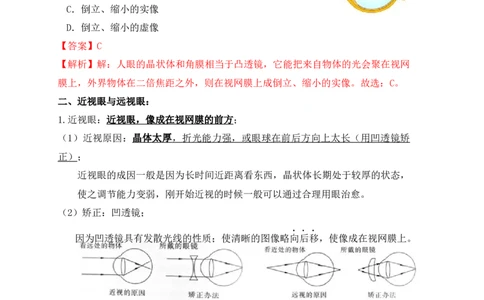 5.4眼睛和眼镜（知识点+例题）(解析版)_初中全科电子版试卷练习试题_物理_8年级上册物理试题_人教版物理八年级上课时练习（104份）_课时练习第1套53